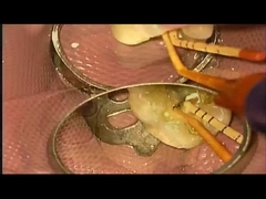 Caso de tratamiento SANI